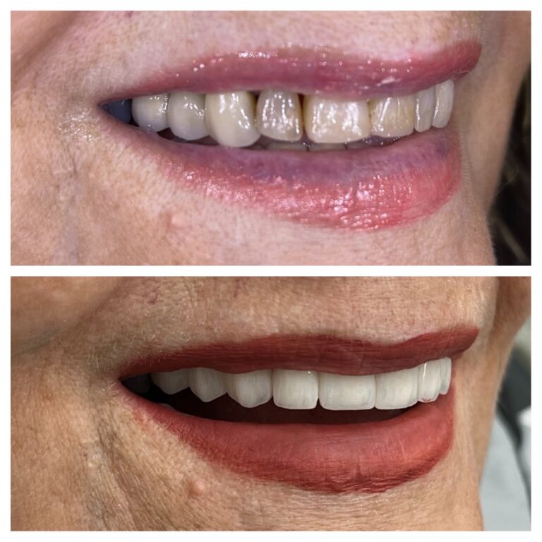 Before and After Photos Nuva Dental